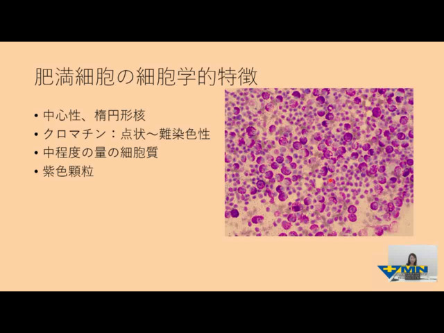 浅川 翠先生の臨床病理学シリーズセミナー
一次診療で知っておきたい臨床病理学
第2回 一次診療で知っておきたい細胞診 ② リンパ節の評価・円形細胞腫瘍 vol.03