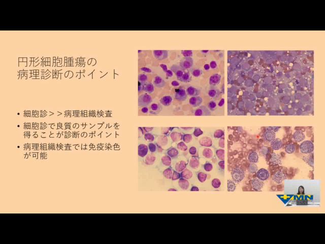 浅川 翠先生の臨床病理学シリーズセミナー
一次診療で知っておきたい臨床病理学
第2回 一次診療で知っておきたい細胞診 ② リンパ節の評価・円形細胞腫瘍 vol.12